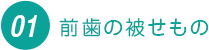 前歯の被せもの